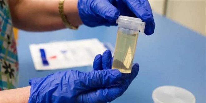 İşe alımlarda 'uyuşturucu testi' dönemi...