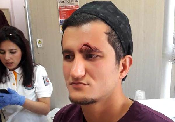 Sivas'ta Diş hekimine saldırı davası sanığına 4 yıl hapis